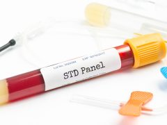 Same-Day STD Testing Results: Quick, Confidential, Reliable